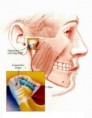 /album/tmj-occlusion/tmj-3-jpg/